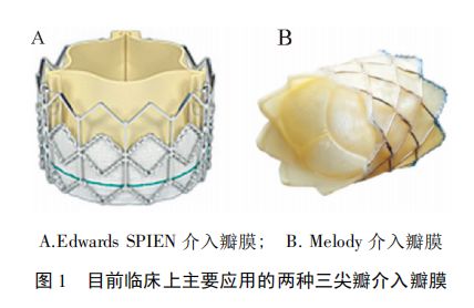经导管三尖瓣介入治疗进展