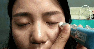 抚平细纹,淡化黑眼圈呈现q弹眼部肌肤眼部问题有两种一种是由于皮肤