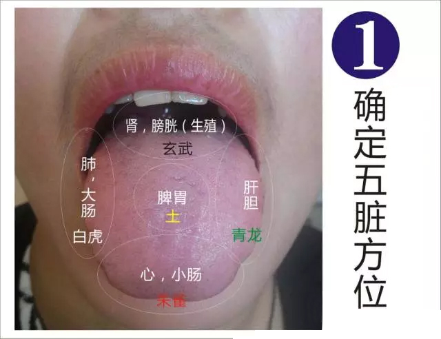 学会这些舌诊就足够诊断百分之70的疾病