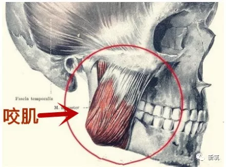 下方的图片看起来感觉找到注射精准的位置很简单对不对,咬肌就在这里