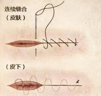 猪场技术外科手术缝合你学会了吗