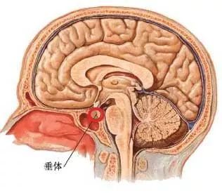 话说肿瘤君相由脑生脑垂体瘤您知多少