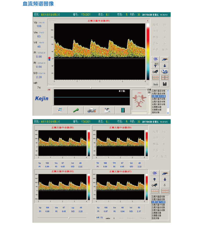 经颅多普勒kj-2v4m可以检查哪些病?