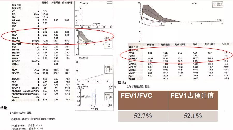 心率120次/分,律齐,a2>p2,叩诊心浊音界正常,腹部查体无异常,双下肢无