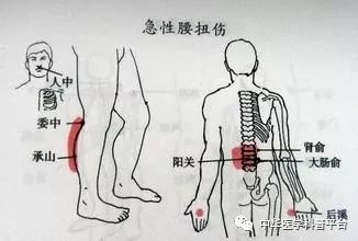 腰被闪了怎么办