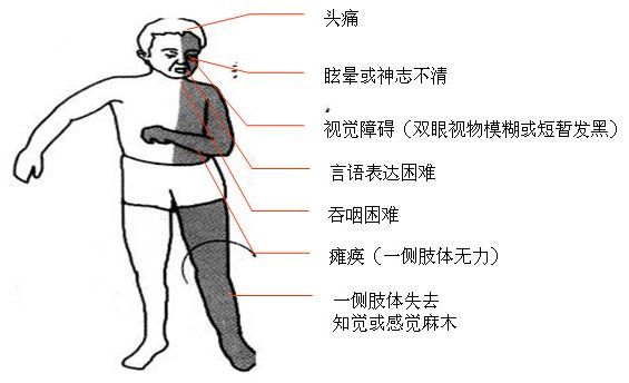 搭飞机头痛怎么办_头痛图片卡通图片(3)