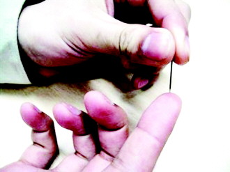 一个有经验的老中医告诉我们:心梗急性发作时,采用十宣穴放血(手指
