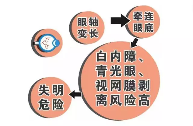 并有150度近视,等他18 岁成年以后,度数将可能增长到500度!