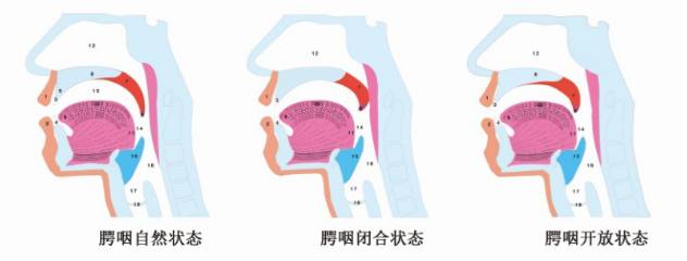 鼻腔还是口腔的功能叫做腭裂闭合功能,顾名思义,是上腭与咽壁的接触