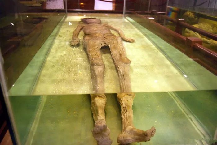 离奇福州南宋古尸历经700多年血管仍有血液流动