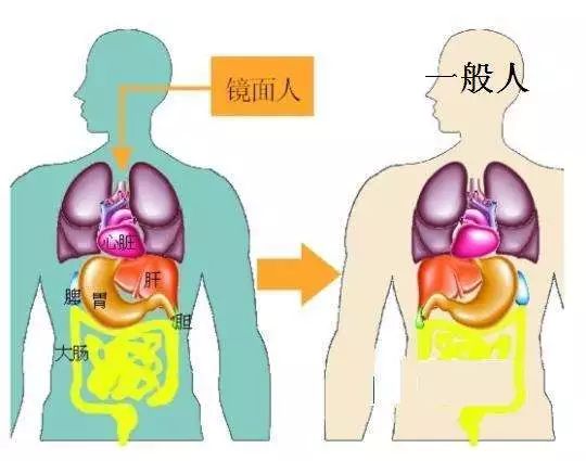 人口肺又称_人口普查(2)