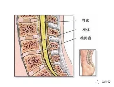 健康 正文  腰椎间盘突出常见症状 1,旁中央突出型,有单侧神经根,及单