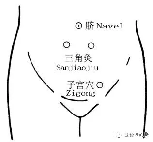 妇科|四大标准,判断是否有妇科病?这些情况一定要做妇