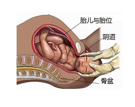 孕晚期左侧睡肚子就痛,是不是压着宝宝了,那应