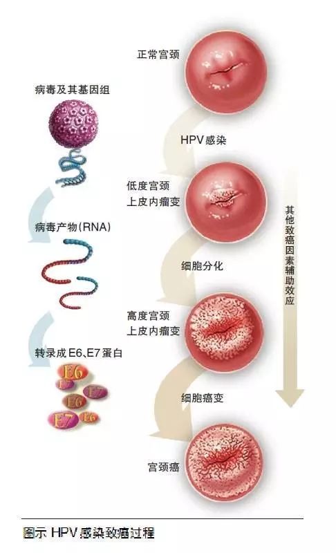 典型表现:形成瘤状,菜花状,颗粒状,鸡冠状.