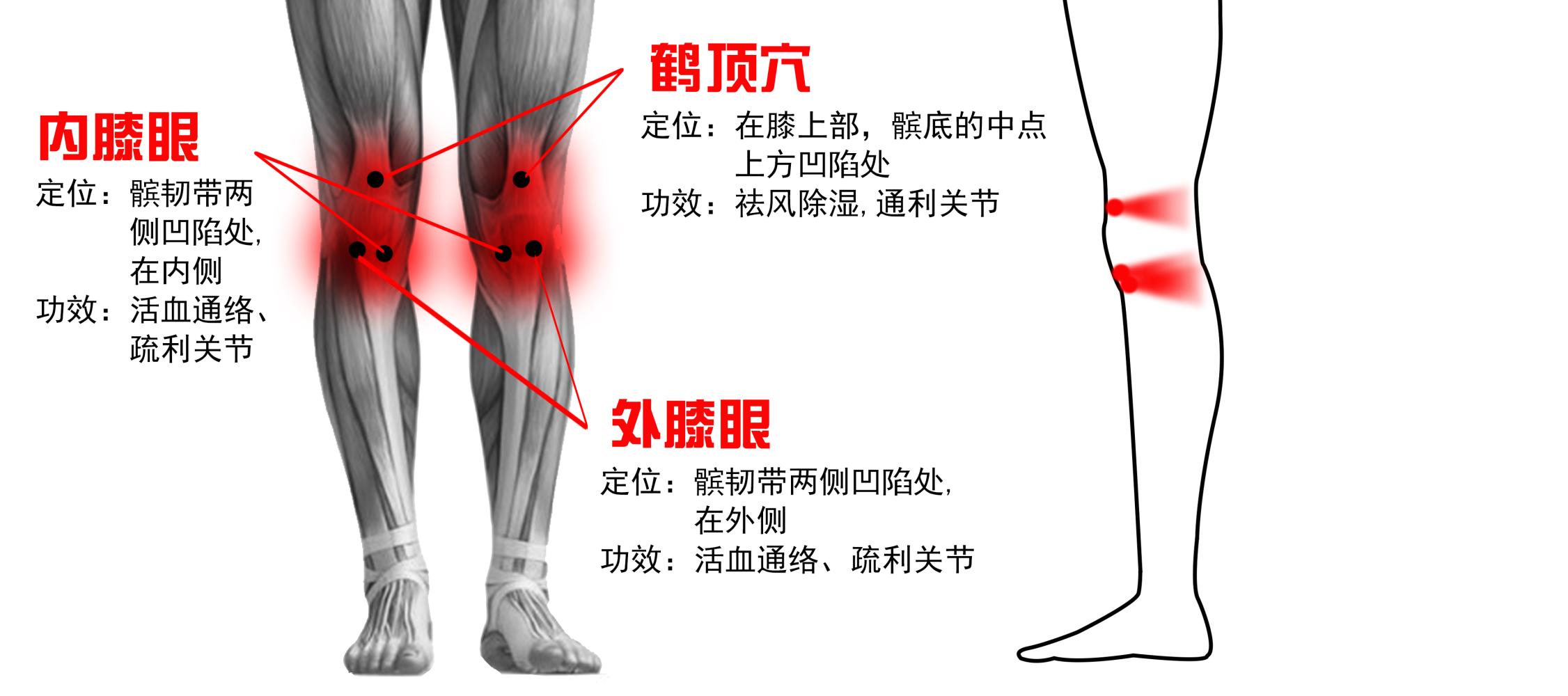 健康 正文  (2)砭灸膝关节鹤顶,内膝眼,犊鼻穴等:从关节进入的"寒湿气