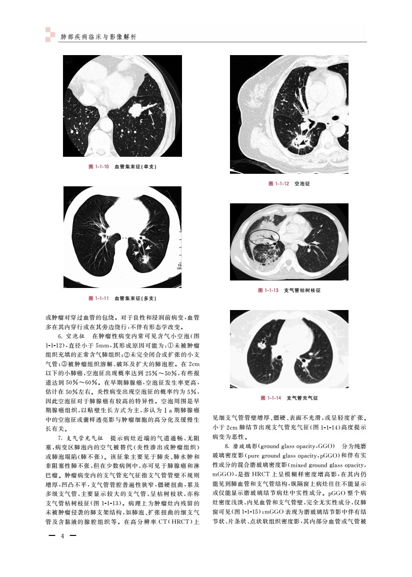 学出版社,为您推荐这本呼吸疾病临床最新力作 《肺部疾病临床与影像