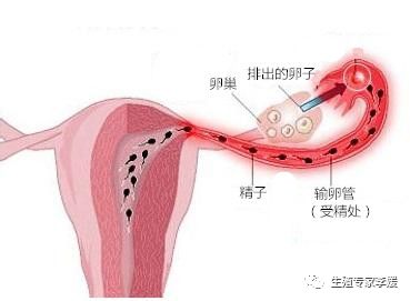 为什么做完输卵管通水后仍未怀孕?