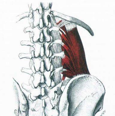 腰部疼痛的首要原因是腰方肌4种腰部锻炼可以缓解疼痛