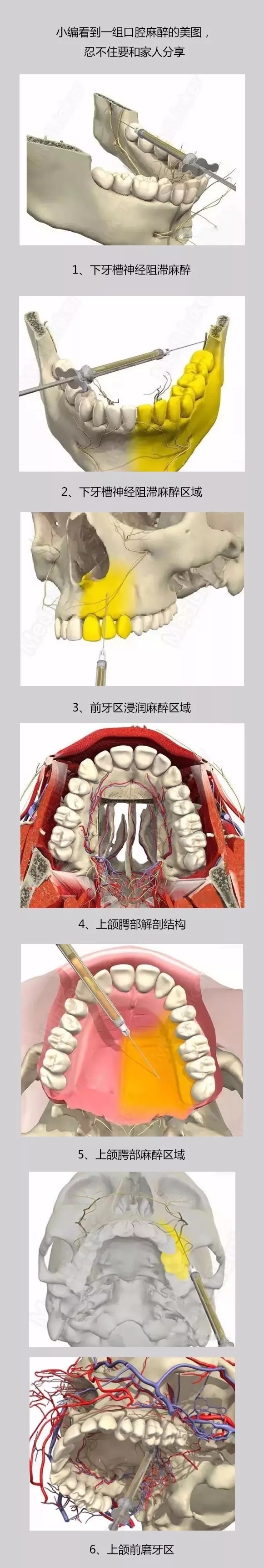 针那叫害怕现在明白怎么打的反倒不怕了在圣安口腔表皮麻醉,浸润麻醉