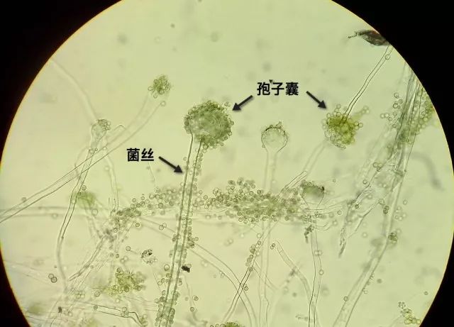 米曲霉(aspergillus oryzae)是一种曲霉属真菌,是日常所说的霉菌之一.