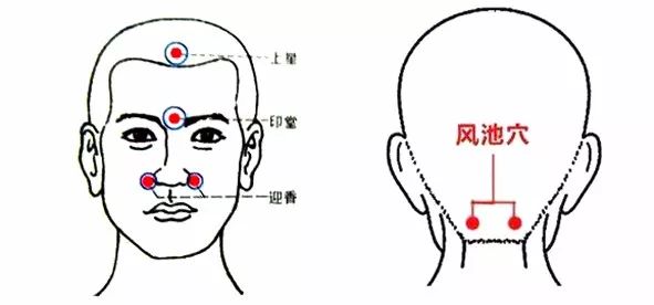 治过敏性鼻炎试试中医四法