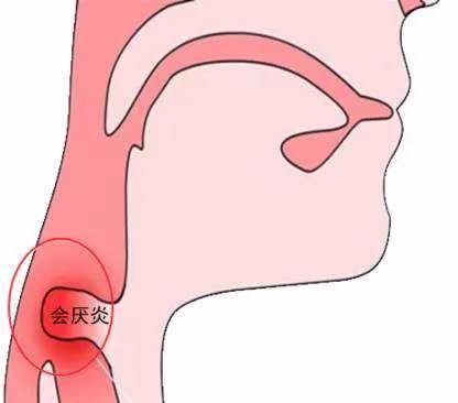 因为知道孙先生曾经得过会厌炎,杨海斌嘱咐点滴结束后千万不能离开