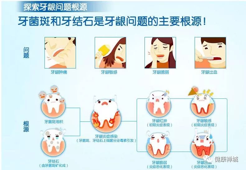 【医生说】为什么牙医总建议你洗牙?看完就懂