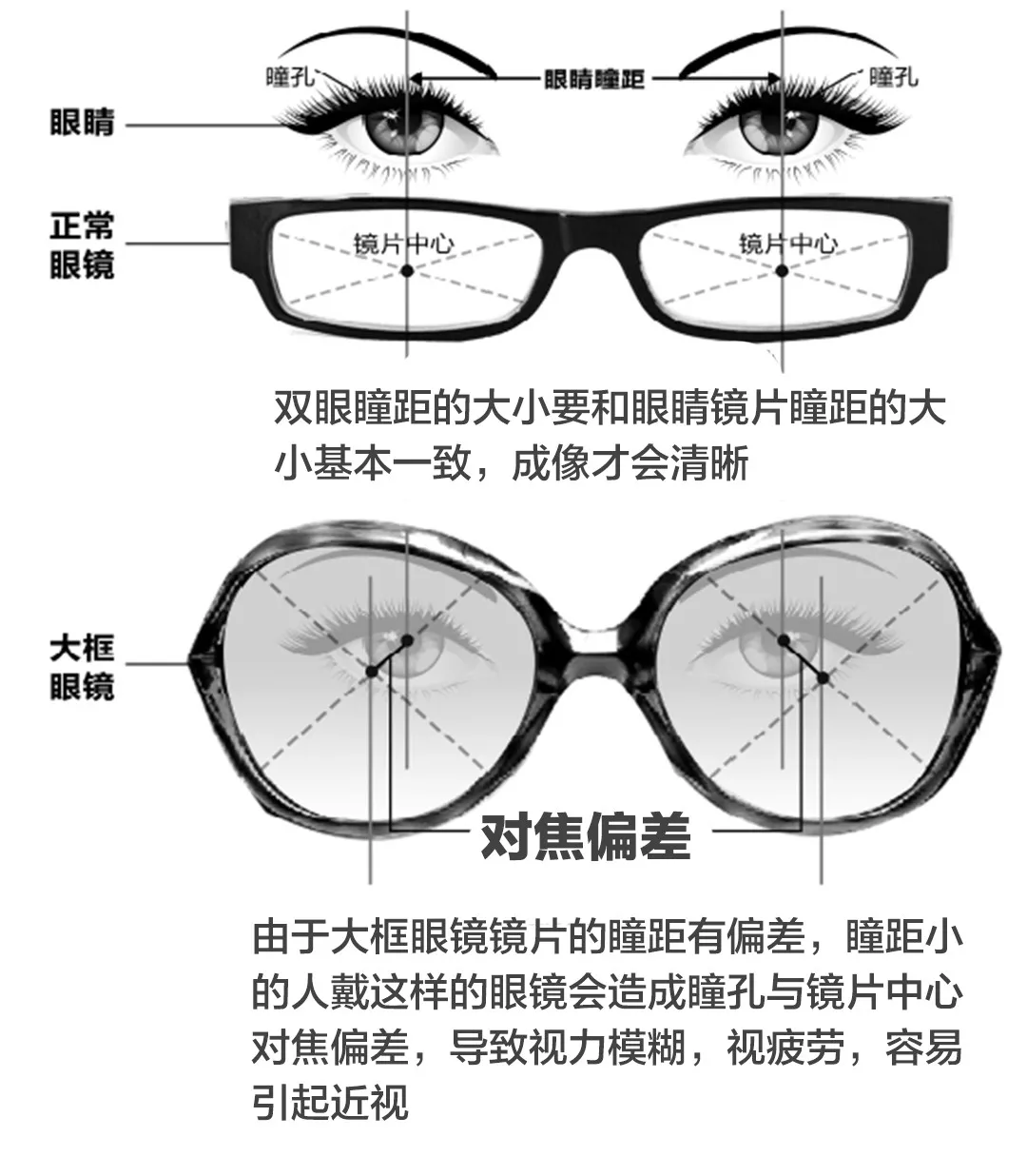 眼镜越大框越时髦?你可能没考虑到这个后果