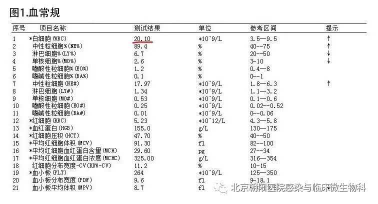 感染科故事之加湿器惹的祸