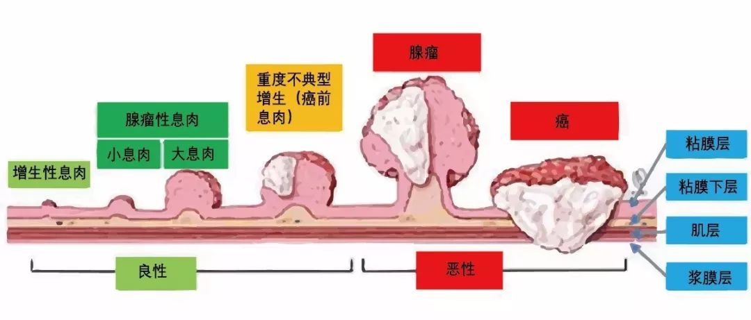 第24个肿瘤宣传周远离大肠癌