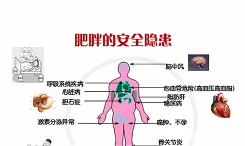 肥胖是慢性致命疾病