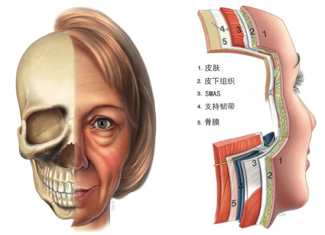 但其实,衰老是发生在面部各个层次结构上的,只是各个层次结构衰老开始