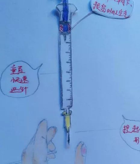 低分子肝素注射,避免皮下出血的改进方法