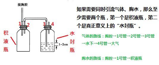 胸腔闭式引流,这四点你未必懂