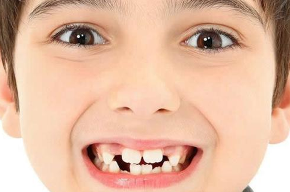 为一个快速生长期,此时矫正受到儿童牙齿骨骼的发育影响,矫正效果比较