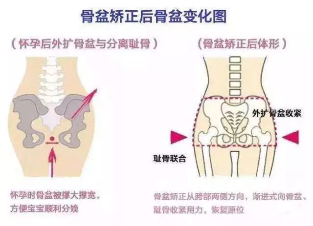 怀孕三个月多,平躺时候骨盆拉痛至腰,什么原因,没怀孕