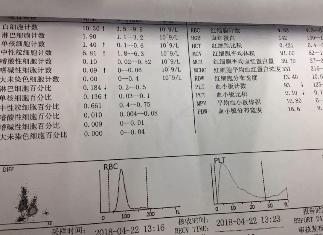 这例aki 为何尿酸高达 2000umol/l?