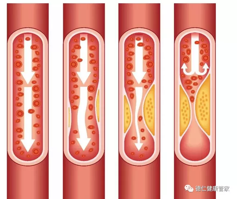 用这1 招让血管畅通,摸一下脚背就知道血管堵不堵!