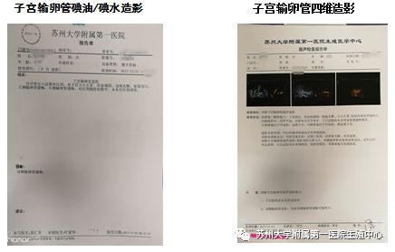 辅助生育技术检查之一子宫输卵管造影