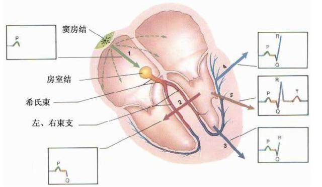 心跳太快和太慢都是病面对房颤怎么办