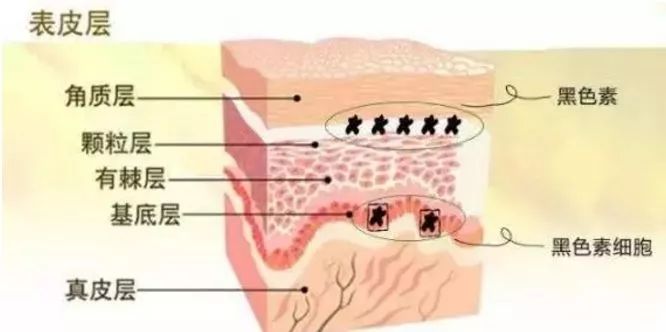 激光祛斑后反黑怎么办