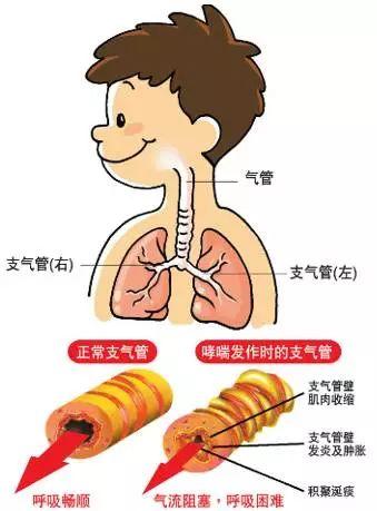 五一假期即将开始,郊游不忘注意儿童哮喘