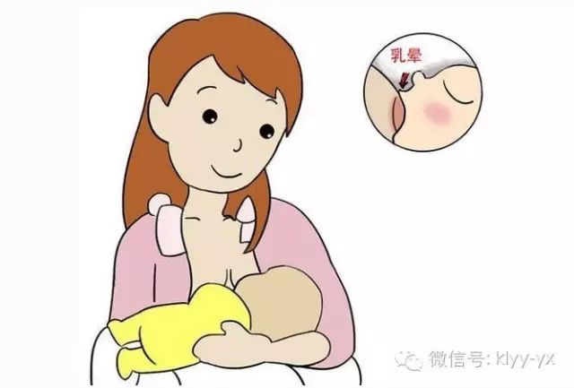 早开奶开奶时间的早晚对于母乳喂养的成功起着一定作用.