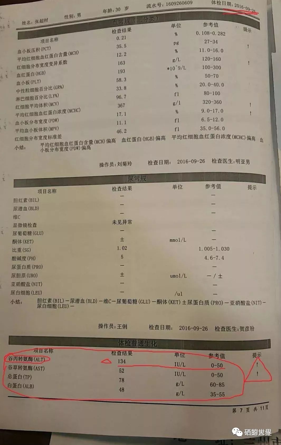 兰州张总身体转氨酶几项指标一直高,通过补硒十个月;单位体检一切正常