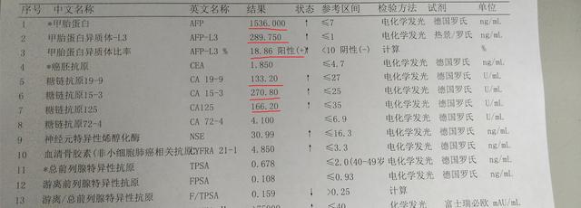 因一次腹胀,却查出了肿瘤,都是乙肝惹得祸(内附ct,化验单)