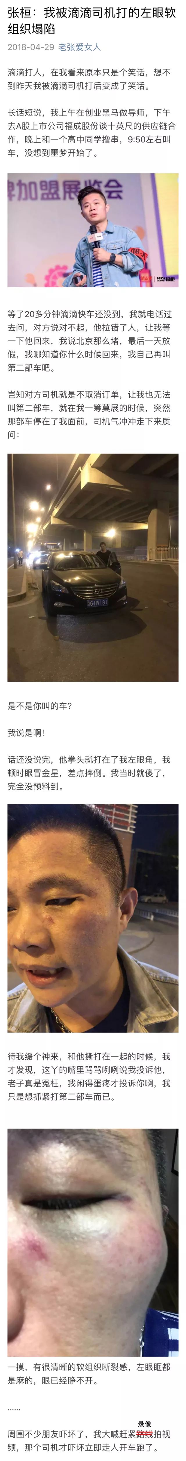 详述了自己叫车挨打的全过程金主爸爸张桓今日凌晨发长文贱卖滴滴的