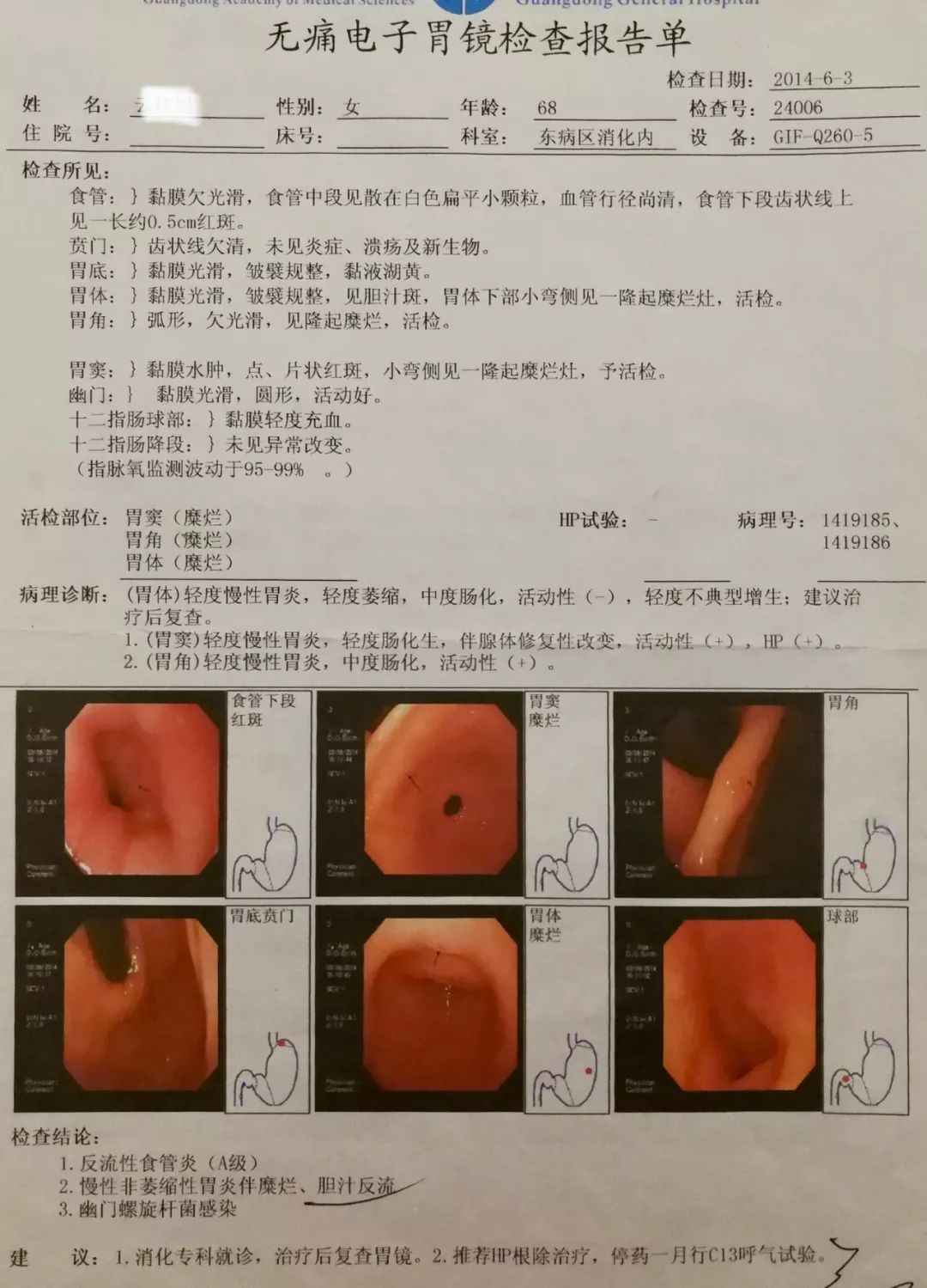 消化问题如何改善