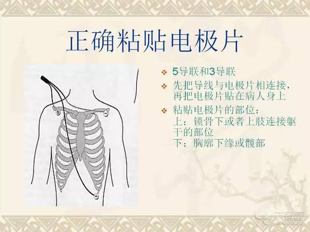 心电监护仪操作指导 这份 ppt 你不可错过