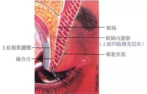 注射层次(1)眉弓塑形:皮下(2)眶区提眉:眶区皮下.